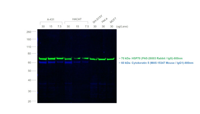 Mouse IgG (H+L) Secondary Antibody in Western Blot (WB)