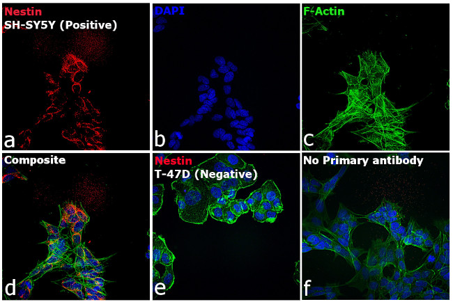 Mouse IgG (H+L) Secondary Antibody in Immunocytochemistry (ICC/IF)