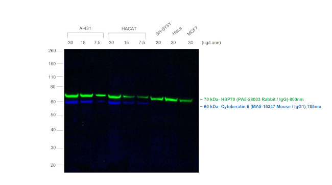 Mouse IgG (H+L) Secondary Antibody in Western Blot (WB)