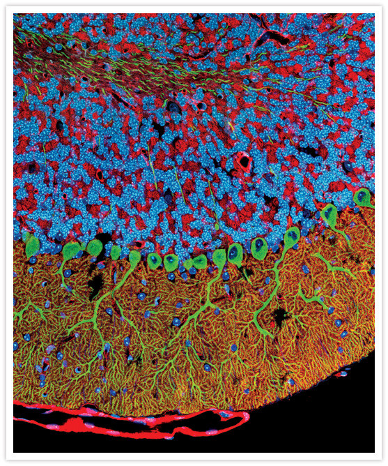 Rabbit IgG (H+L) Secondary Antibody in Immunohistochemistry (IHC)