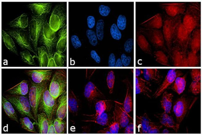 Rabbit IgG (H+L) Secondary Antibody in Immunocytochemistry (ICC/IF)