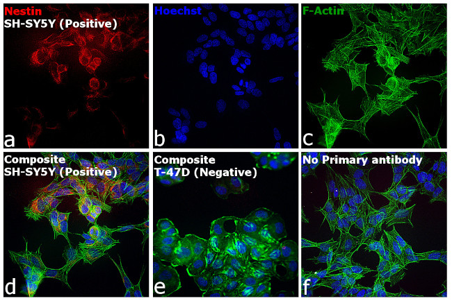 Mouse IgG (H+L) Secondary Antibody in Immunocytochemistry (ICC/IF)