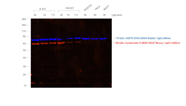 Mouse IgG (H+L) Secondary Antibody in Western Blot (WB)