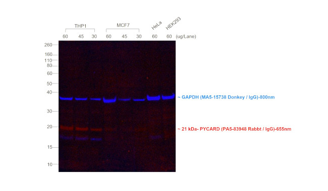 Rabbit IgG (H+L) Secondary Antibody in Western Blot (WB)