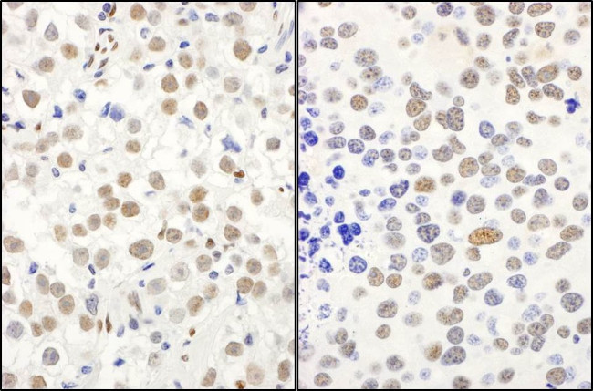 QKI Antibody in Immunohistochemistry (IHC)