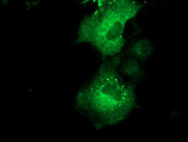 QPRT Antibody in Immunocytochemistry (ICC/IF)