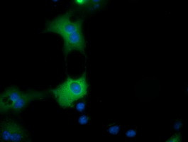 QPRT Antibody in Immunocytochemistry (ICC/IF)