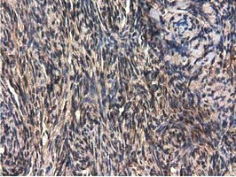 QPRT Antibody in Immunohistochemistry (Paraffin) (IHC (P))