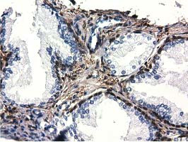 QPRT Antibody in Immunohistochemistry (Paraffin) (IHC (P))