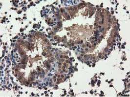 QPRT Antibody in Immunohistochemistry (Paraffin) (IHC (P))