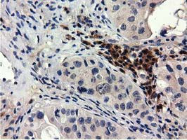 QPRT Antibody in Immunohistochemistry (Paraffin) (IHC (P))