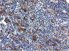 QPRT Antibody in Immunohistochemistry (Paraffin) (IHC (P))