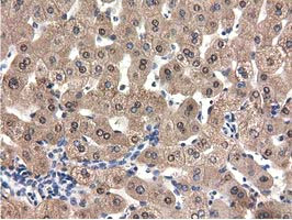 QPRT Antibody in Immunohistochemistry (Paraffin) (IHC (P))