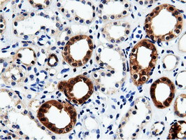 QPRT Antibody in Immunohistochemistry (Paraffin) (IHC (P))