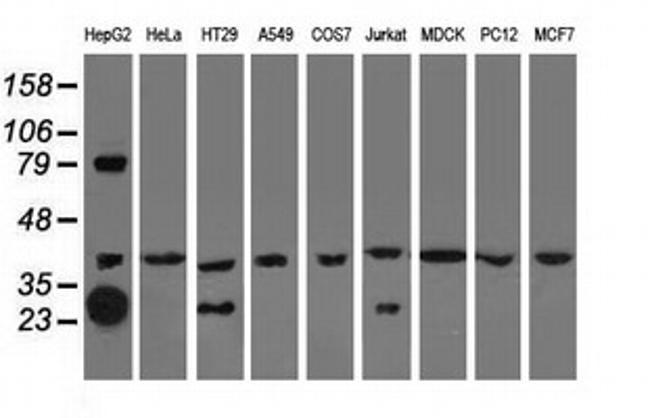 QPRT Antibody in Western Blot (WB)