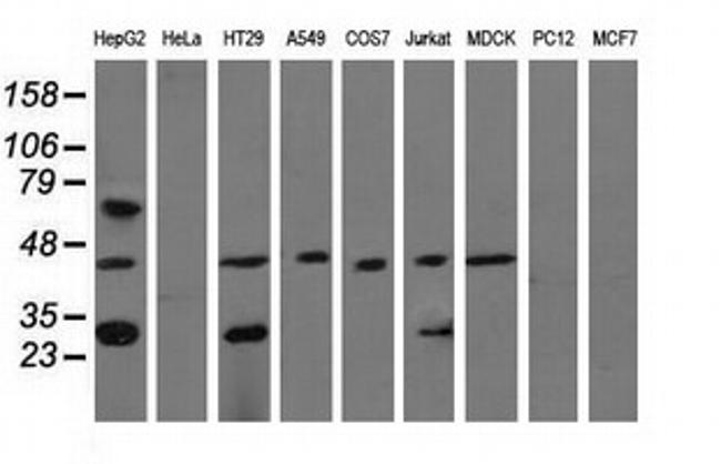 QPRT Antibody in Western Blot (WB)