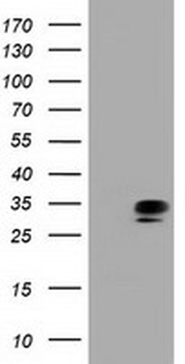 QPRT Antibody in Western Blot (WB)