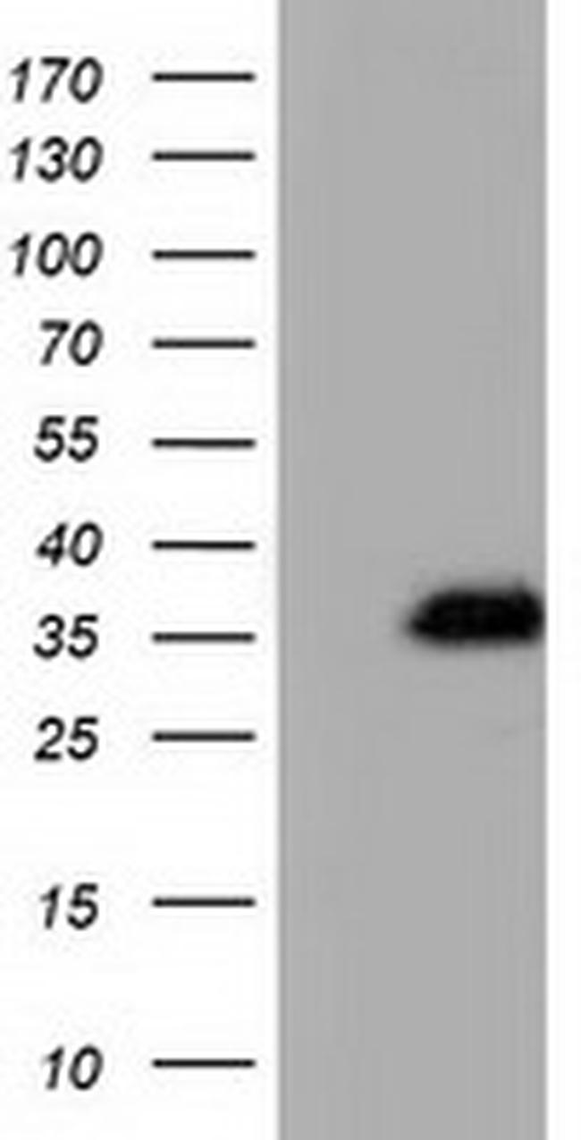 QPRT Antibody in Western Blot (WB)