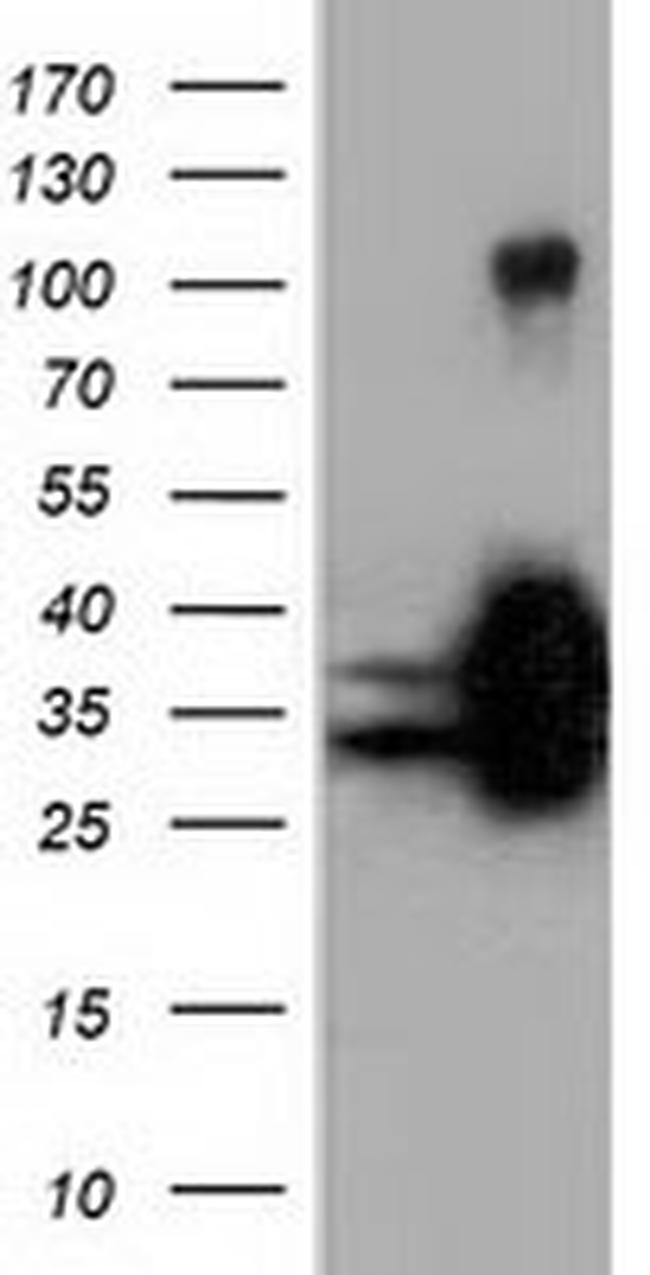 QPRT Antibody in Western Blot (WB)