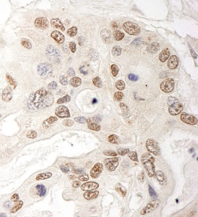 QSER1 Antibody in Immunohistochemistry (IHC)