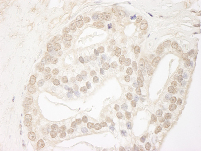 QSER1 Antibody in Immunohistochemistry (IHC)