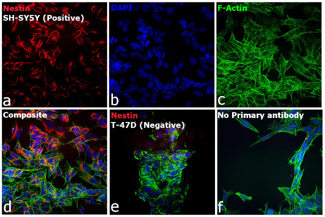 Mouse IgG (H+L) Cross-Adsorbed Secondary Antibody in Immunocytochemistry (ICC/IF)