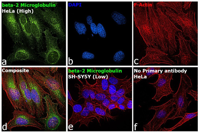 beta-2 Microglobulin Antibody