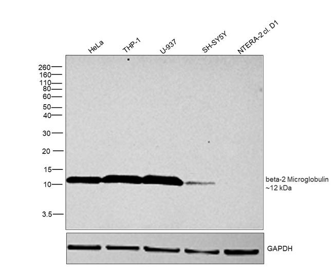 beta-2 Microglobulin Antibody in Western Blot (WB)