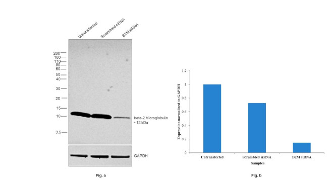 beta-2 Microglobulin Antibody