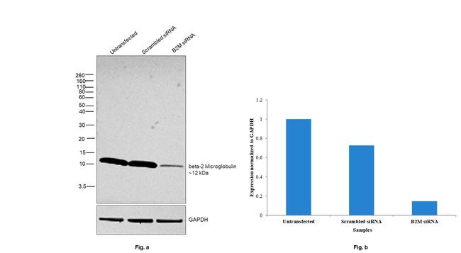 beta-2 Microglobulin Antibody in Western Blot (WB)