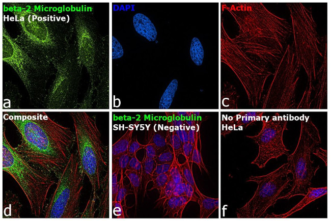 beta-2 Microglobulin Antibody