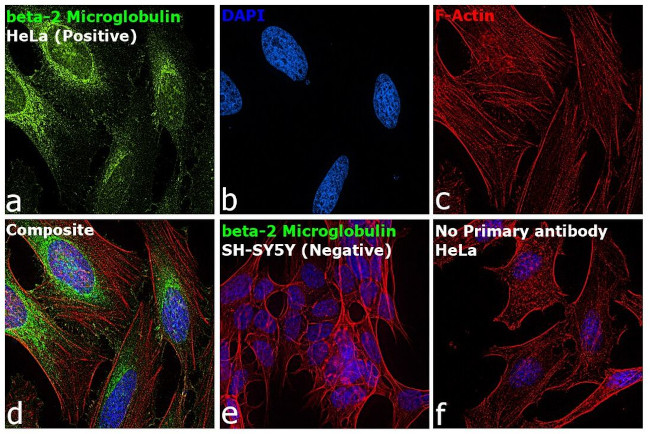 beta-2 Microglobulin Antibody in Immunocytochemistry (ICC/IF)