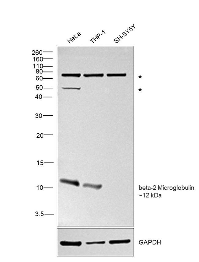 beta-2 Microglobulin Antibody in Western Blot (WB)