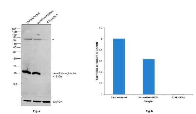 beta-2 Microglobulin Antibody in Western Blot (WB)