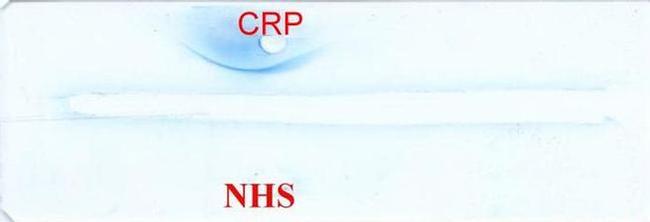 CRP Antibody in Immunoelectrophoresis (IE)