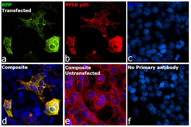 TagRFP Antibody in Immunocytochemistry (ICC/IF)