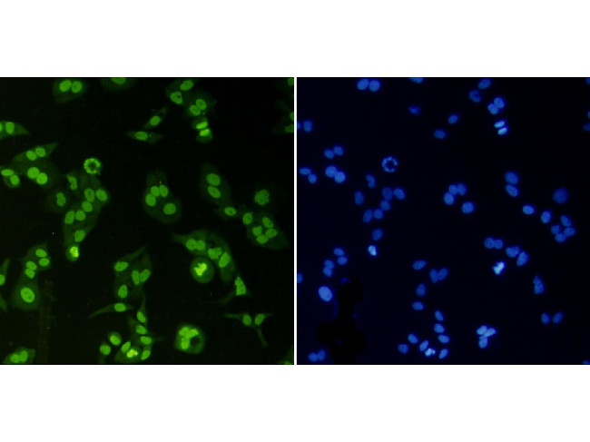 Histone H3 (di-methyl K4) Antibody in Immunocytochemistry (ICC/IF)