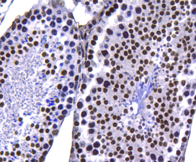 Histone H3 (di-methyl K4) Antibody in Immunohistochemistry (Paraffin) (IHC (P))