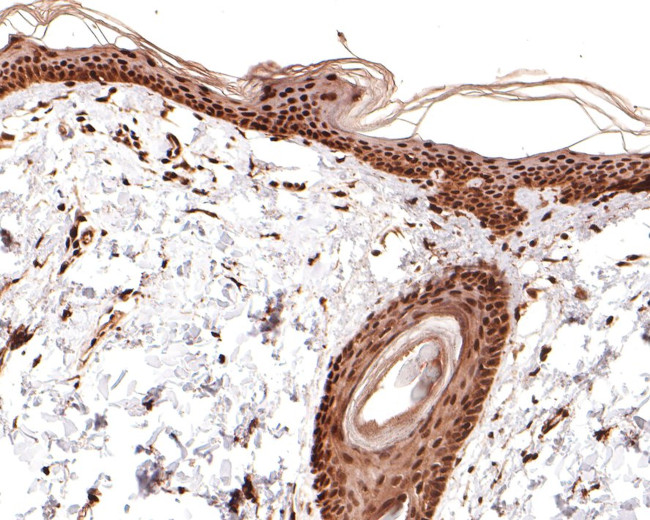 KLF4 Antibody in Immunohistochemistry (Paraffin) (IHC (P))