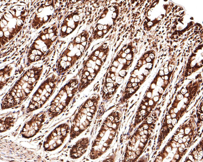 KLF4 Antibody in Immunohistochemistry (Paraffin) (IHC (P))