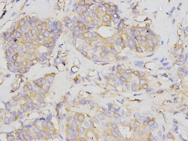 NF-kappa B p105/p50 Antibody in Immunohistochemistry (Paraffin) (IHC (P))