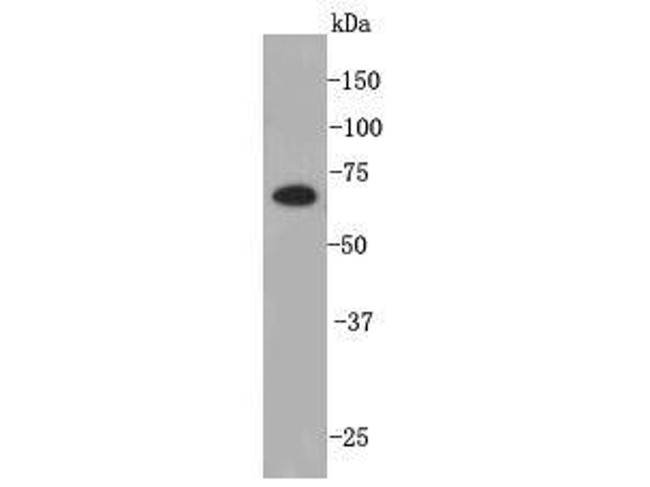 PRDM14 Antibody in Western Blot (WB)