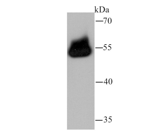 TRAF6 Antibody in Western Blot (WB)