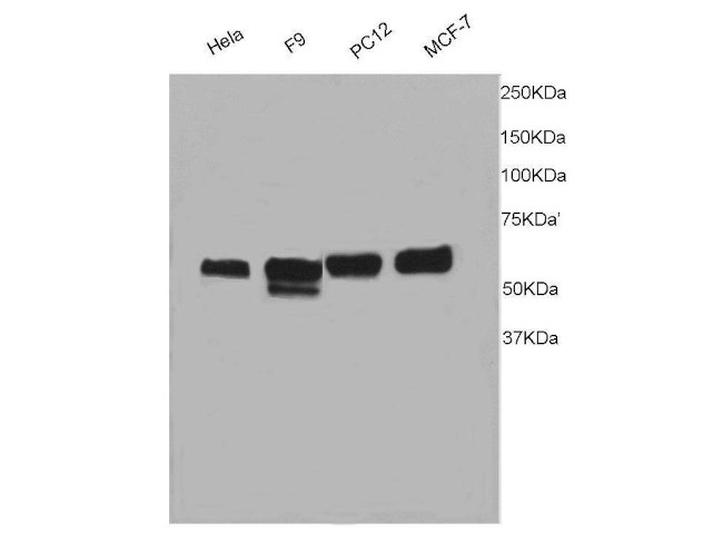 TRAF6 Antibody in Western Blot (WB)