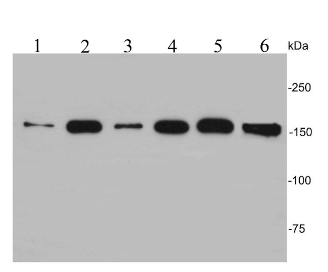 EEA1 Antibody in Western Blot (WB)