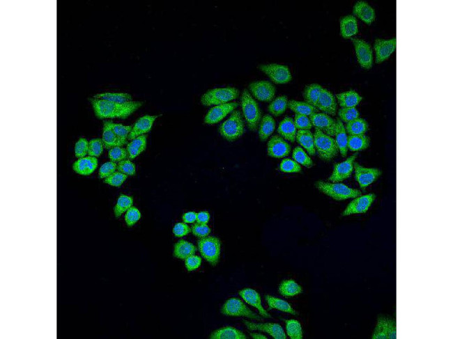 ALDH2 Antibody in Immunocytochemistry (ICC/IF)