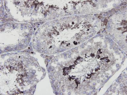 eNOS Antibody in Immunohistochemistry (Paraffin) (IHC (P))