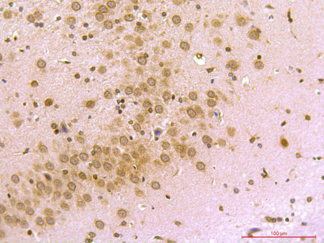 PSD95 Antibody in Immunohistochemistry (Paraffin) (IHC (P))