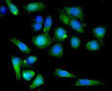 BMPR1A Antibody in Immunocytochemistry (ICC/IF)