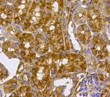 BMPR1A Antibody in Immunohistochemistry (Paraffin) (IHC (P))